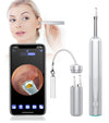 Wireless WiFi Otoscope Ear Cleaner with Gyroscope | Smart Endoscope Ear Inspection Camera for Earwax Removal